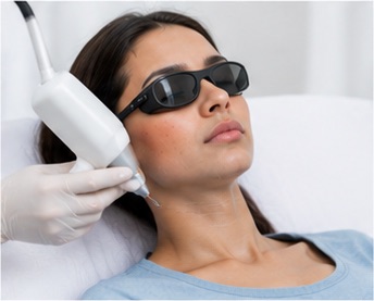 CO2 Laser Treatment