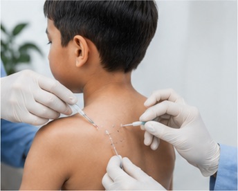 Skin Allergy Testing Guide
