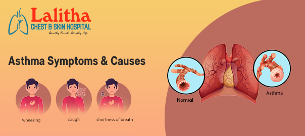 Everything You Need To Know About Asthma: Types, Symptoms & Causes