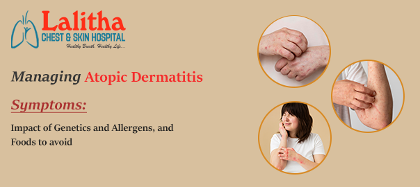 Managing Atopic Dermatitis: Causes, Impact of Genetics & Foods to Avoid