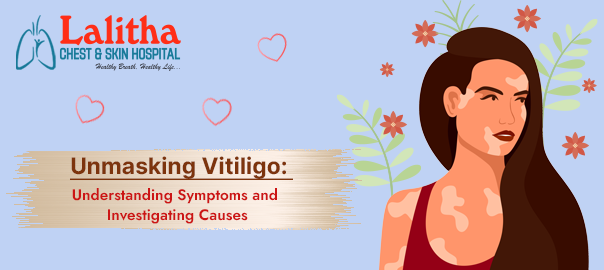 Unmasking Vitiligo: Understanding Its Symptoms, Causes & Treatment Options