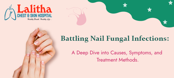 Get Rid of Toenail Fungus: Revealing Causes & Effective Treatments