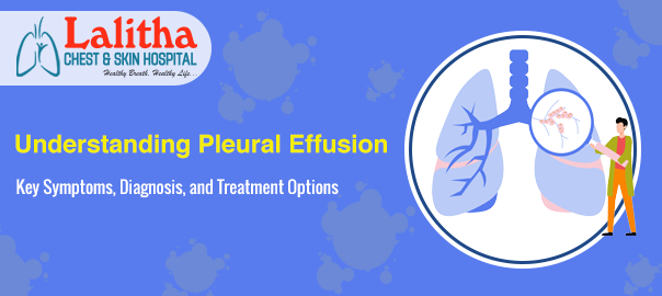 Understanding Pleural Effusion Symptoms, Diagnosis & Treatment