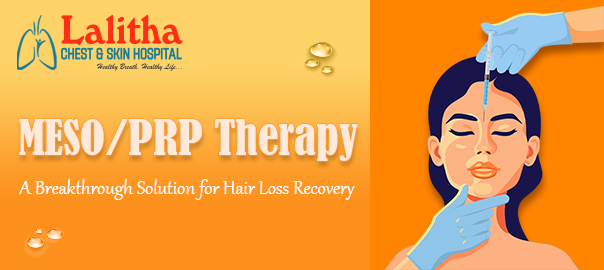 Hair Loss Solution with MESO/PRP Therapy | Restore Your Hair