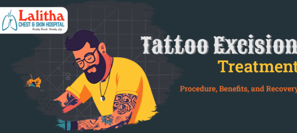Tattoo Excision Surgery: Permanent Tattoo Removal Explained