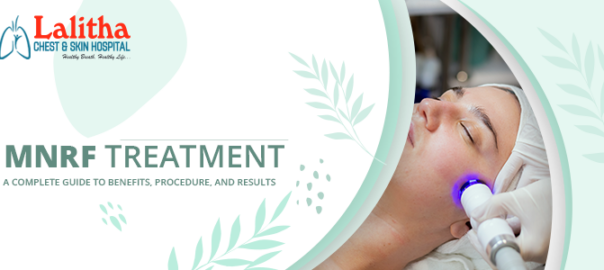 MNRF Treatment: Benefits, Procedure & Results Guide