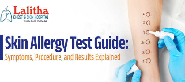 Skin Allergy Test Guide | Symptoms, Procedure, and Results