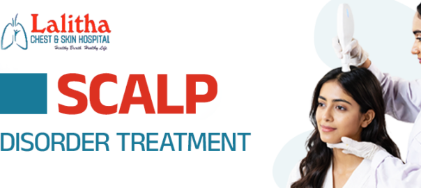 Scalp Disorders | Causes, Symptoms, and Treatments