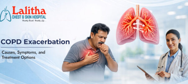 COPD Exacerbation: Causes, Symptoms, and Treatment Options